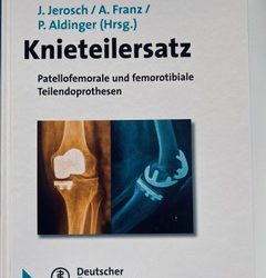 Cap 7.2: Bi-uni und bi-uni + femoro-patellarer Gelenkersatz